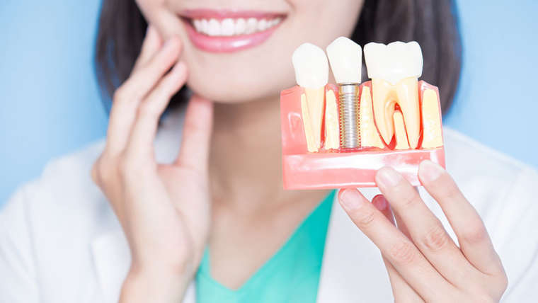 Implant czy most? Porównanie rozwiązań 1 Implant czy most? Porównanie rozwiązań