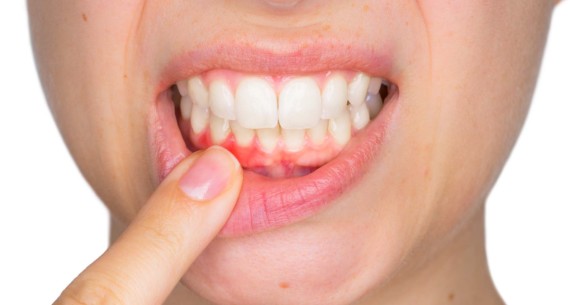 Podstawy domowej higieny jamy ustnej