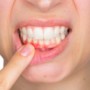 Podstawy domowej higieny jamy ustnej